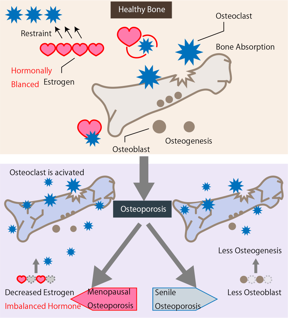 Osteoporosis System