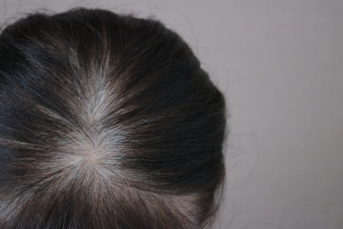 menopause woman's hair