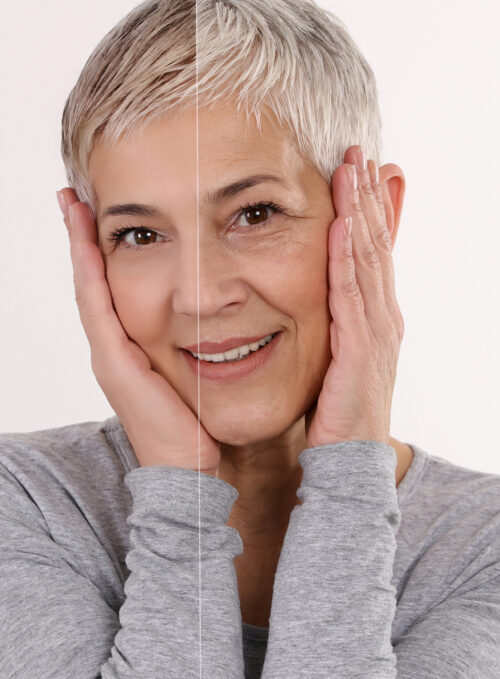 natural anti wrinkle skin care